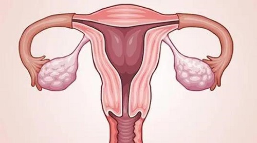 美国试管婴儿：子宫肌瘤切除后要多久才能移植囊胚？
