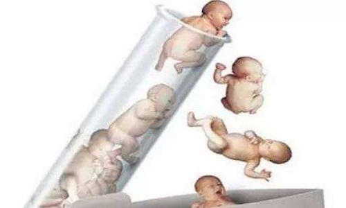 试管婴儿的孩子有什么缺陷啊？