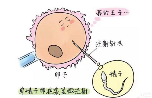 谱写美国试管婴儿好孕之歌