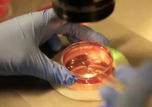 造成卵巢功能下降的因素是什么？美国试管如何定方案？